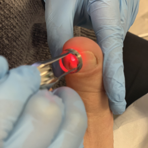 Remoção de Fungos e Derrames - 15 de Março