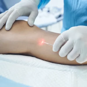 Endolaser Facial e Corporal